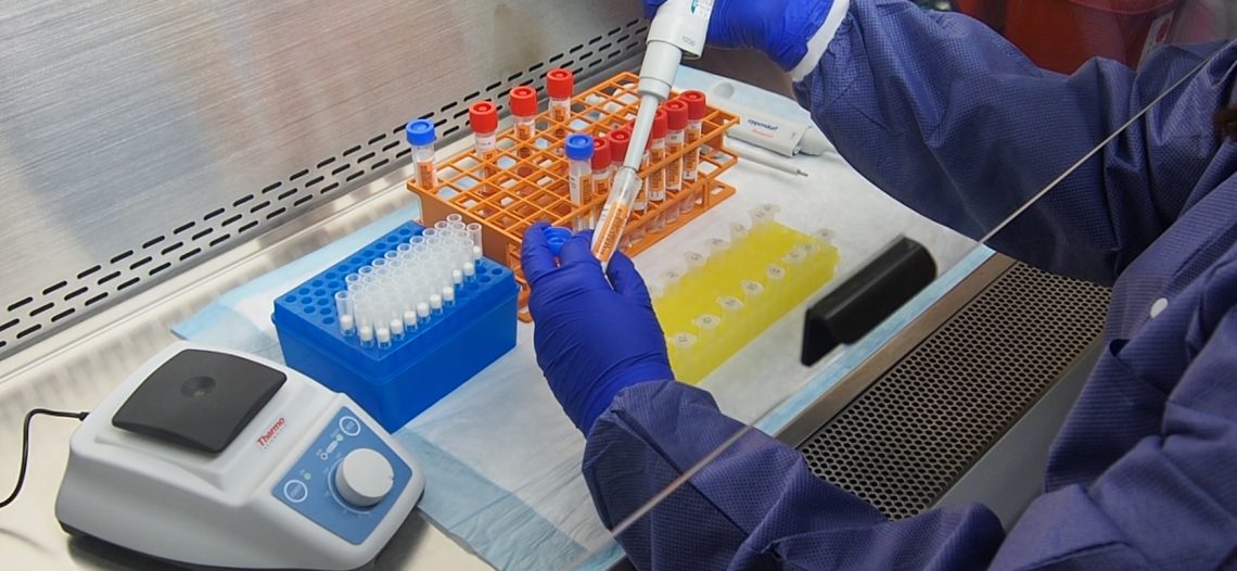 Hallazgo en Francia; detectan nueva variante de covid