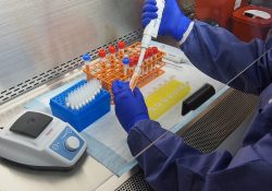 Hallazgo en Francia; detectan nueva variante de covid