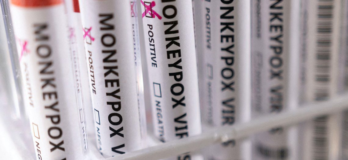 Viruela del mono podría ser de ‘alto riesgo’ si llega a grupos más sensibles: OMS