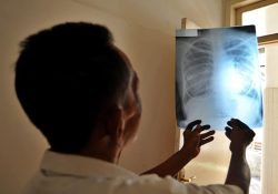 La Tuberculosis Vuelve a Propagarse en el Mundo: OMS