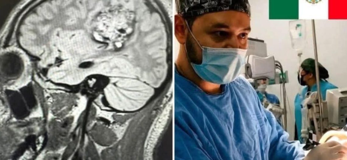 México hace historia: IMSS realiza exitosa cirugía cerebral pediátrica con paciente despierto en Yucatán