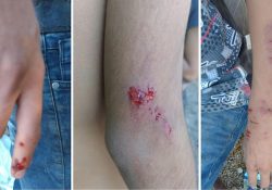 Carro rojo atropella a dos menores en Loma Linda y huye del lugar