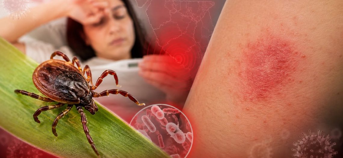 Guaymas, entre los municipios con más decesos por fiebre manchada en Sonora